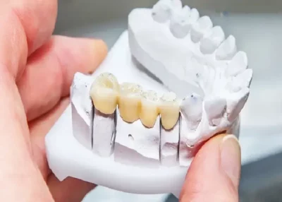 ست قالبگیری اسپیدکس